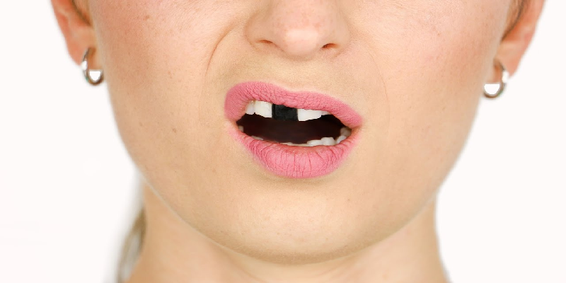 Ngủ Mơ Thấy Rụng Răng Đánh Số Mấy? Ý Nghĩa Giấc Mơ Rụng Răng - pixon